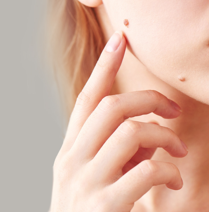 Chirurgia dermatologica
