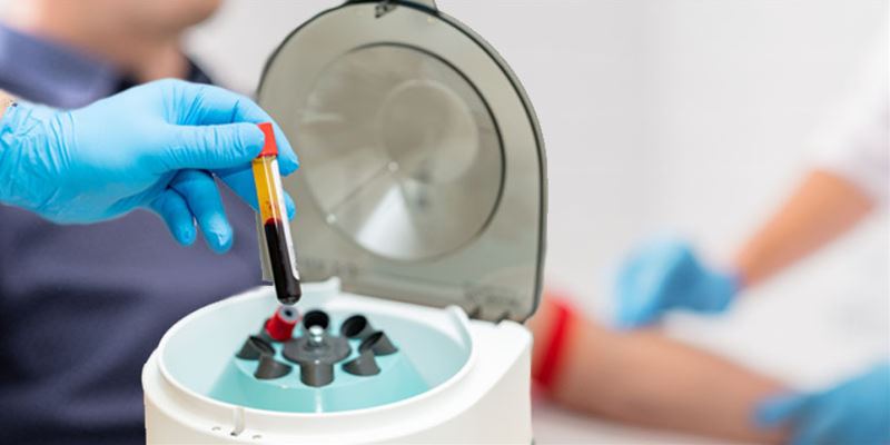 prp centrifuga