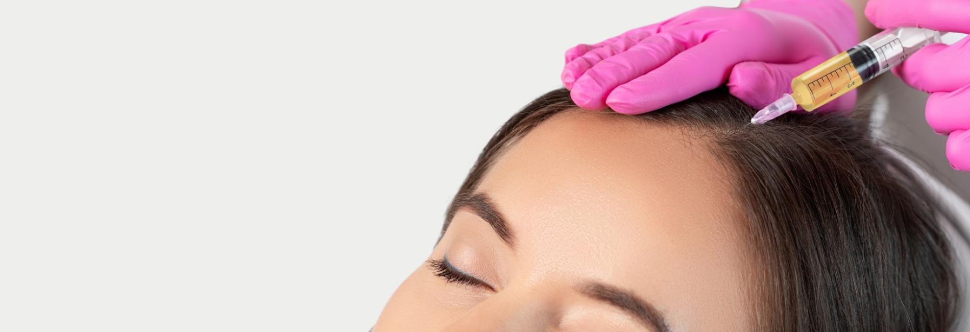 Il PRP è considerato tra i metodi non invasivi più efficace <br />per ripristinare e infoltire i capelli. <span style="color:#5b6571;">PRP</span> CAPELLI