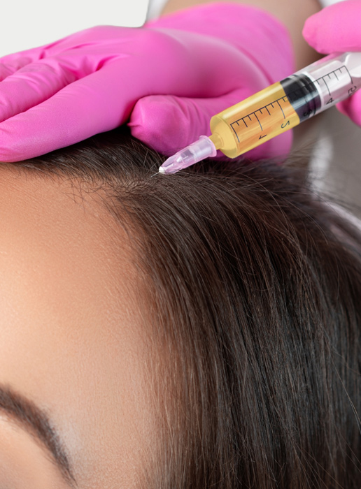&nbsp     Il PRP è considerato tra i metodi non invasivi più efficace per ripristinare e infoltire i capelli.  <span style="color:#5b6571;">PRP</span> CAPELLI
